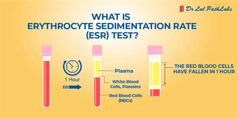 ESR .